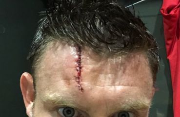 milner injury